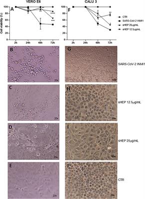 In vitro Evaluation of Antiviral Efficacy of a Standardized Hydroalcoholic Extract of Poplar Type Propolis Against SARS-CoV-2